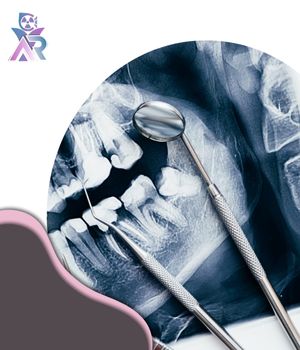 چه زمانی عکس از دندان نیاز است؟ چه زمانی عکس از دندان نیاز است؟