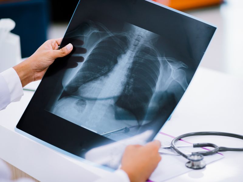 رادیولوژی دیجیتال