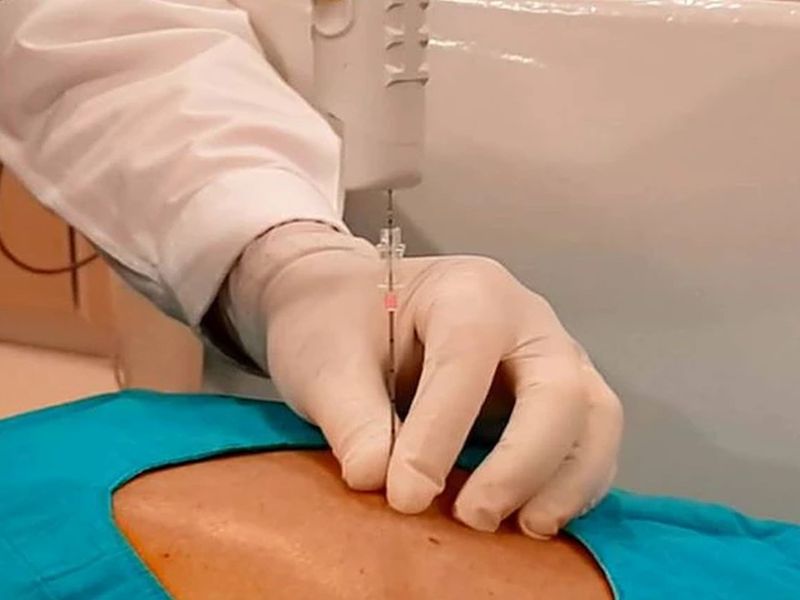 نمونه برداری