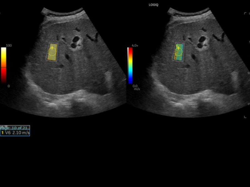  الاستوگرافی