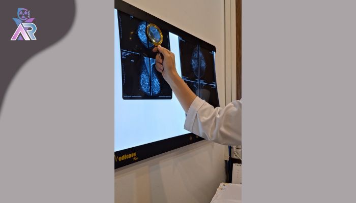بررسی ماموگرافی توسط خانم دکتر