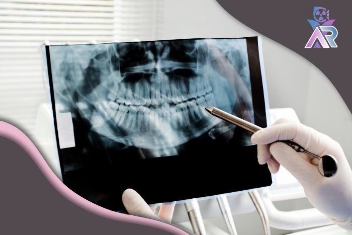 آیا عکس دندان برای زنان باردار خطر دارد؟ آنچه باید بدانید