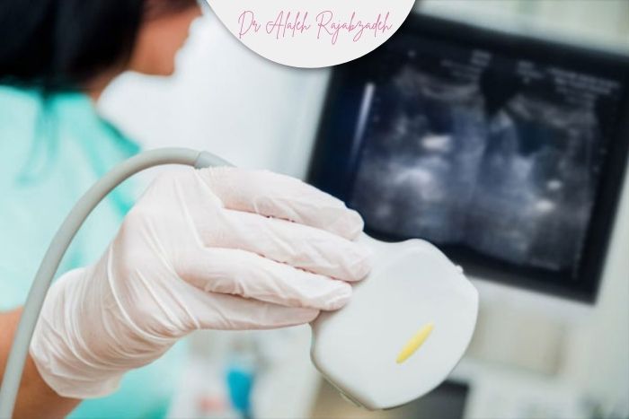 آیا کیست ‌های ساده نیاز به پیگیری با سونوگرافی دارند؟