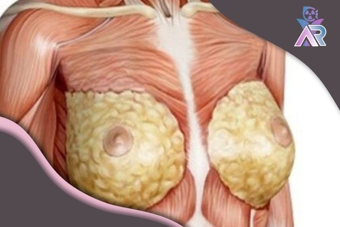 بافت سینه زنان جوان با زنان مسن چه تفاوتی دارد؟ بافت سینه زنان جوان با زنان مسن چه تفاوتی دارد؟