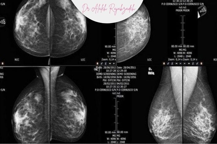 تفاوت روشهای تصویربرداری در گروههای سنی مختلف تفاوت روشهای تصویربرداری در گروههای سنی مختلف