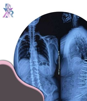 توتال اسپاین (Total Spine) توتال اسپاین (Total Spine)