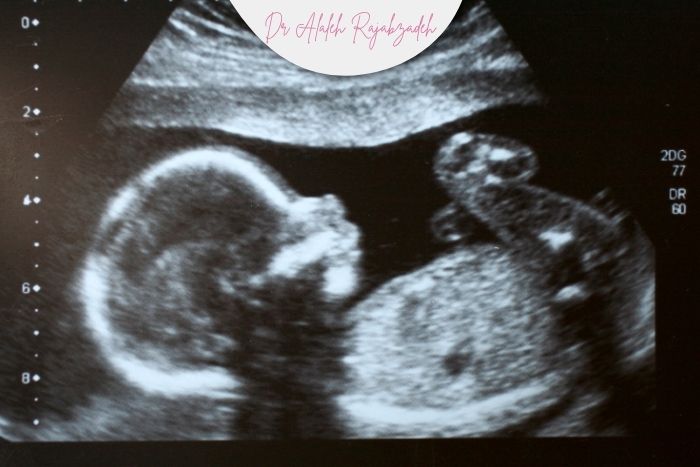 زمان‌ های طلایی انجام سونوگرافی در بارداری