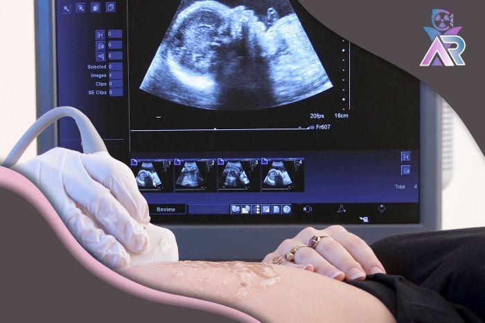 سونوگرافی بیوفیزیکال پروفایل چیست و چه کاربردی دارد؟
