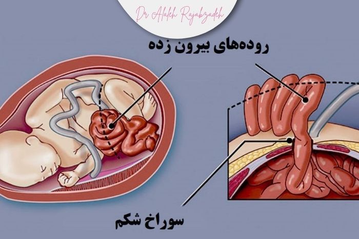 ناهنجاری‌های قابل تشخیص با سونوگرافی غربالگری