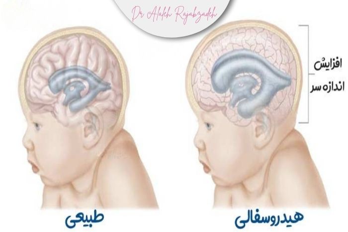 ناهنجاری‌های قابل تشخیص در سونوگرافی