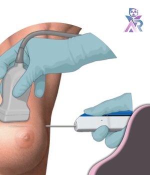 تفاوت بیوپسی و FNA تفاوت بیوپسی و FNA
