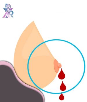 چه زمانی پزشک سونوگرافی را توصیه می‌کند؟