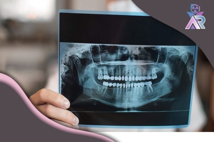 عکس دندان پوسیدگیهای عمیق را نشان میدهد؟ عکس دندان پوسیدگیهای عمیق را نشان میدهد؟